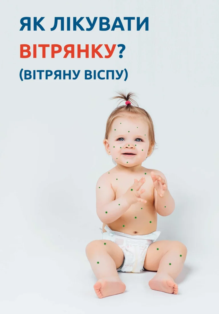 Як виглядає вітрянка: стадії висипу та ознаки
